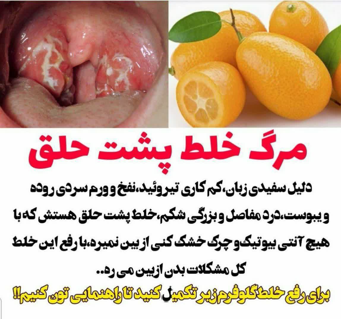 دریافت خلت پشت گلو دارین ؟حجم