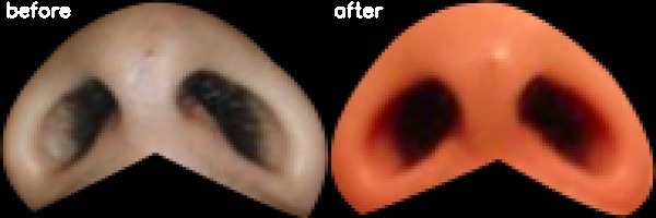 دریافت بیمار 11