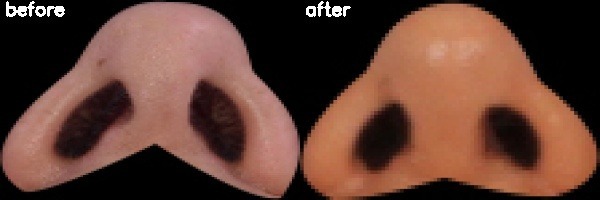 دریافت بیمار 47