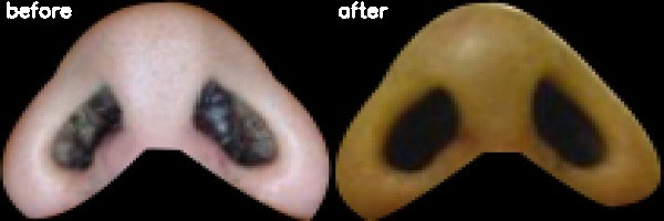 دریافت بیمار 10