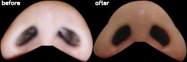 دریافت بیمار 8