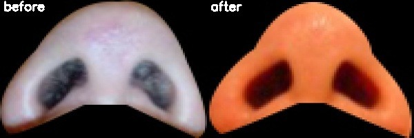 دریافت بیمار 1