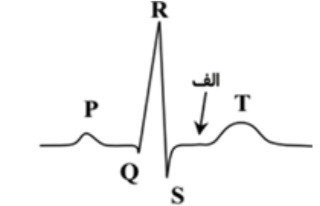 دریافت سوال 41