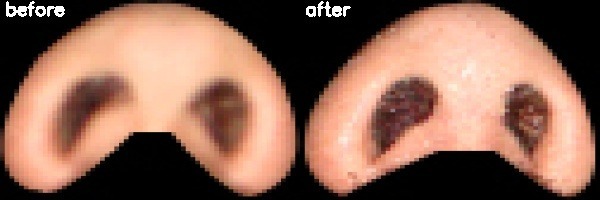 دریافت بیمار 38