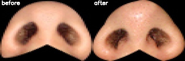 دریافت بیمار 40