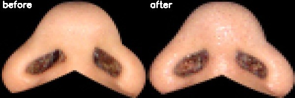 دریافت بیمار 31