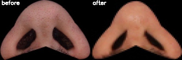 دریافت بیمار 43