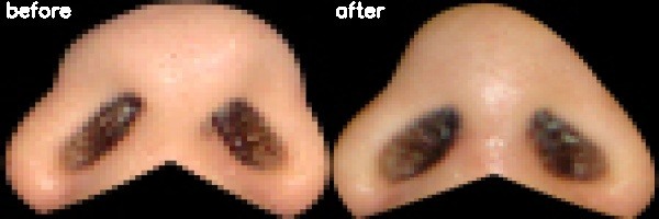 دریافت بیمار 35