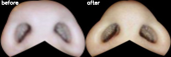 دریافت بیمار 6