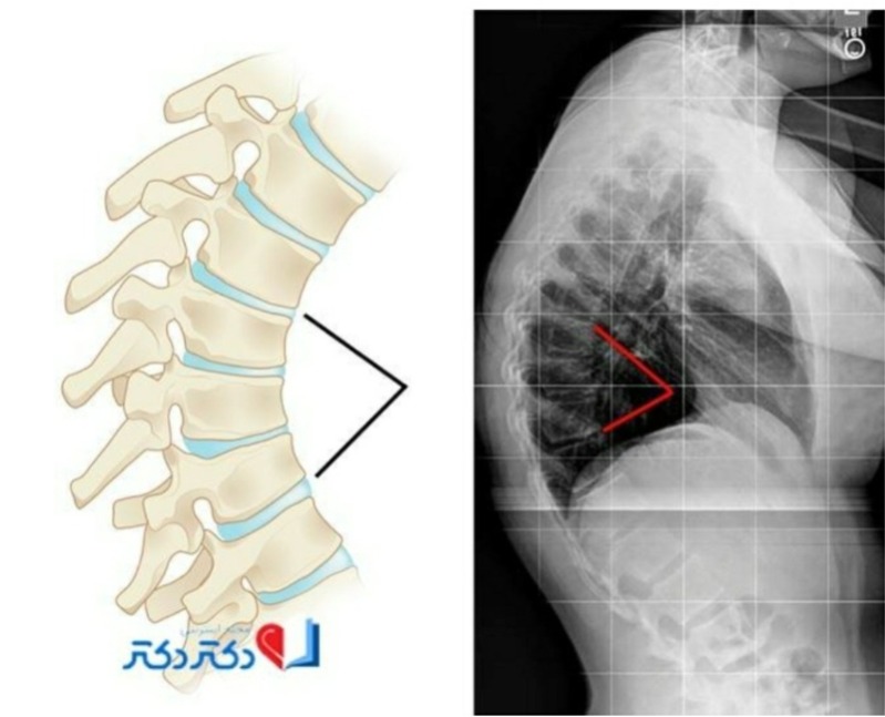 دریافت سوال 15