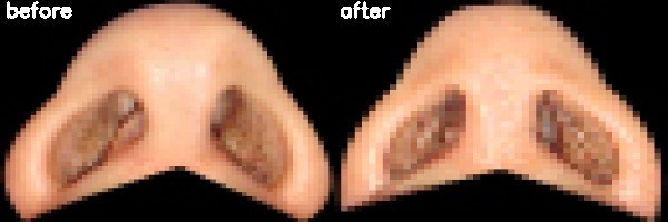 دریافت بیمار 29