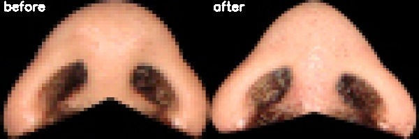 دریافت بیمار 26