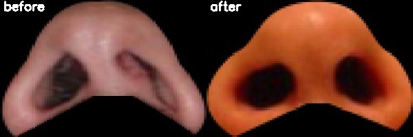 دریافت بیمار 14