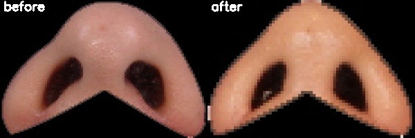 دریافت بیمار 41