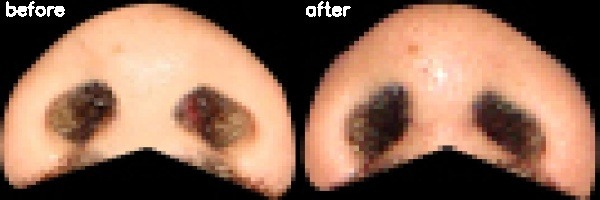 دریافت بیمار 34