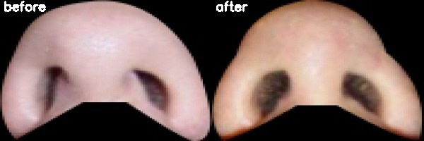 دریافت بیمار 2