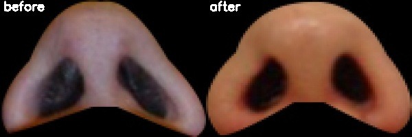 دریافت بیمار 9