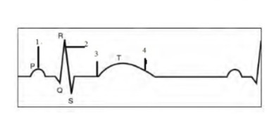 دریافت سوال 35