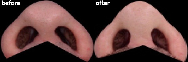 دریافت بیمار 46