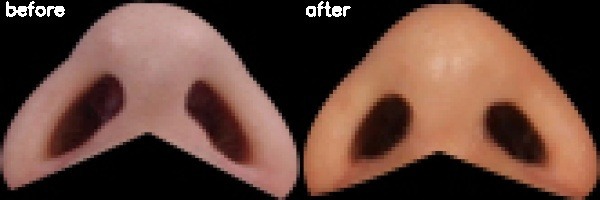 دریافت بیمار 45