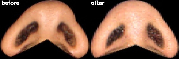 دریافت بیمار 33