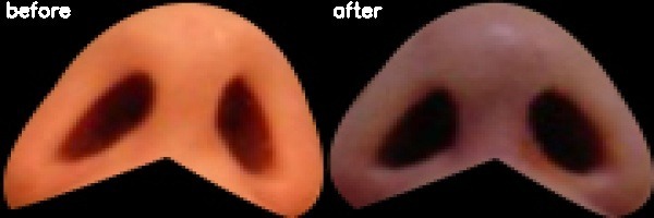 دریافت بیمار 21