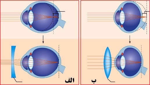 دریافت سوال 11