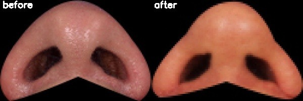 دریافت بیمار 42