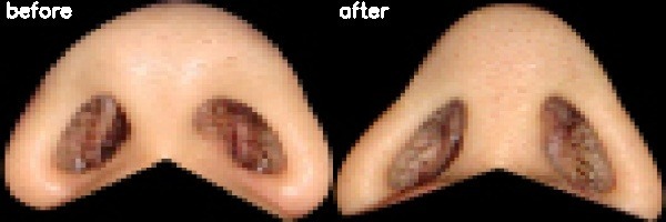 دریافت بیمار 32