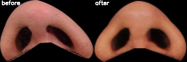 دریافت بیمار 44