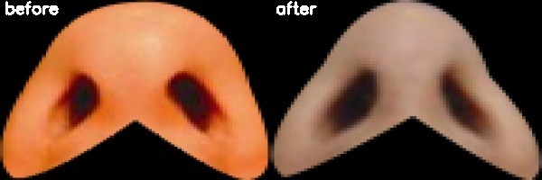 دریافت بیمار 20