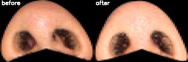 دریافت بیمار 30