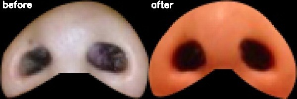 دریافت بیمار 3