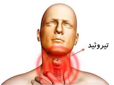 دریافت دچار تیروئید هستید؟