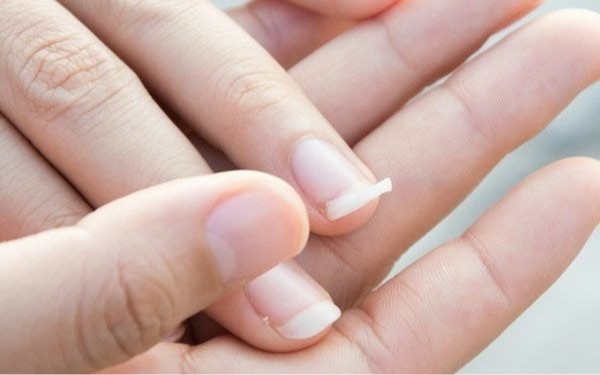 دریافت ریزش مو شکنندگی ناخن